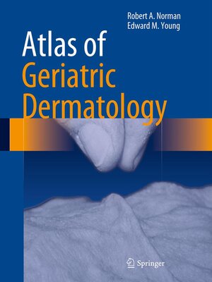 cover image of Atlas of Geriatric Dermatology